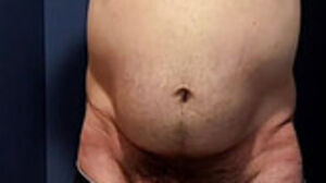 Huge gut and knob out and well-prepped