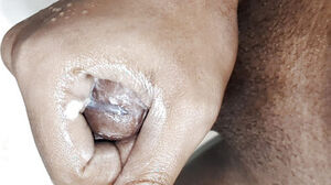 Bangladeshi doc youthfull boy treating mal out vid